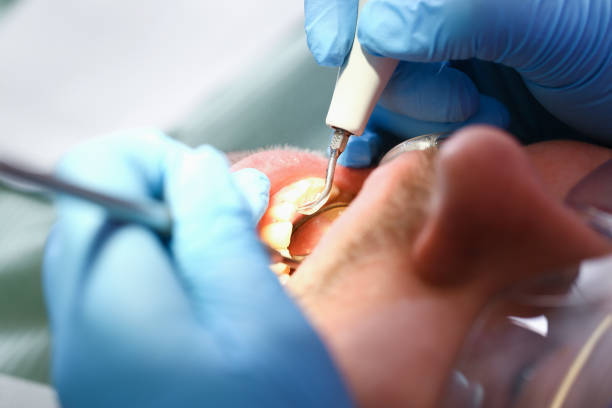 Best Emergency Treatment for Toothache in Clovis, NM