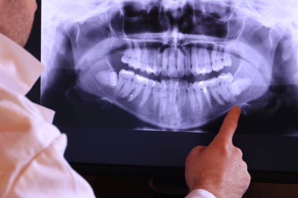 Best Emergency Treatment for Toothache in Clovis, NM